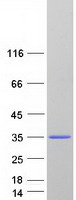 Coomassie blue staining of purified NAA60 protein (Cat# TP313483). The protein was produced from HEK293T cells transfected with NAA60 cDNA clone (Cat# RC213483) using MegaTran 2.0 (Cat# TT210002).