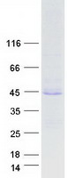 Coomassie blue staining of purified HPS1 protein (Cat# TP313679). The protein was produced from HEK293T cells transfected with HPS1 cDNA clone (Cat# RC213679) using MegaTran 2.0 (Cat# TT210002).