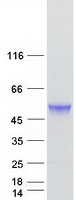 Coomassie blue staining of purified TBCEL protein (Cat# TP315292). The protein was produced from HEK293T cells transfected with TBCEL cDNA clone (Cat# RC215292) using MegaTran 2.0 (Cat# TT210002).
