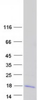 Coomassie blue staining of purified LARP6 protein (Cat# TP315460). The protein was produced from HEK293T cells transfected with LARP6 cDNA clone (Cat# RC215460) using MegaTran 2.0 (Cat# TT210002).