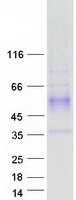 Coomassie blue staining of purified WDR83 protein (Cat# TP315520). The protein was produced from HEK293T cells transfected with WDR83 cDNA clone (Cat# RC215520) using MegaTran 2.0 (Cat# TT210002).