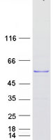 Coomassie blue staining of purified TSPYL4 protein (Cat# TP315564). The protein was produced from HEK293T cells transfected with TSPYL4 cDNA clone (Cat# RC215564) using MegaTran 2.0 (Cat# TT210002).