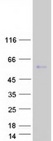 Coomassie blue staining of purified MORN1 protein (Cat# TP315575). The protein was produced from HEK293T cells transfected with MORN1 cDNA clone (Cat# RC215575) using MegaTran 2.0 (Cat# TT210002).