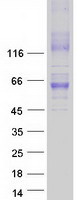 Coomassie blue staining of purified SLC30A1 protein (Cat# TP315616). The protein was produced from HEK293T cells transfected with SLC30A1 cDNA clone (Cat# RC215616) using MegaTran 2.0 (Cat# TT210002).