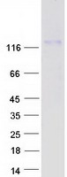 Coomassie blue staining of purified MRTFB protein (Cat# TP315687). The protein was produced from HEK293T cells transfected with MRTFB cDNA clone (Cat# RC215687) using MegaTran 2.0 (Cat# TT210002).