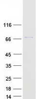 Coomassie blue staining of purified TIGD6 protein (Cat# TP315809). The protein was produced from HEK293T cells transfected with TIGD6 cDNA clone (Cat# RC215809) using MegaTran 2.0 (Cat# TT210002).