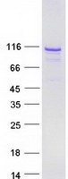 Coomassie blue staining of purified BEND3 protein (Cat# TP315913). The protein was produced from HEK293T cells transfected with BEND3 cDNA clone (Cat# RC215913) using MegaTran 2.0 (Cat# TT210002).