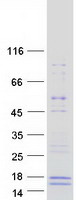 Coomassie blue staining of purified GALP protein (Cat# TP316301). The protein was produced from HEK293T cells transfected with GALP cDNA clone (Cat# RC216301) using MegaTran 2.0 (Cat# TT210002).