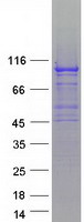 Coomassie blue staining of purified SLFN5 protein (Cat# TP316330). The protein was produced from HEK293T cells transfected with SLFN5 cDNA clone (Cat# RC216330) using MegaTran 2.0 (Cat# TT210002).