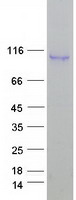 Coomassie blue staining of purified ELP2 protein (Cat# TP317279). The protein was produced from HEK293T cells transfected with ELP2 cDNA clone (Cat# RC217279) using MegaTran 2.0 (Cat# TT210002).