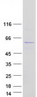 Coomassie blue staining of purified UBXN6 protein (Cat# TP317394). The protein was produced from HEK293T cells transfected with UBXN6 cDNA clone (Cat# RC217394) using MegaTran 2.0 (Cat# TT210002).