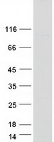 Coomassie blue staining of purified IQUB protein (Cat# TP317498). The protein was produced from HEK293T cells transfected with IQUB cDNA clone (Cat# RC217498) using MegaTran 2.0 (Cat# TT210002).