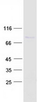 Coomassie blue staining of purified PAN3 protein (Cat# TP318027). The protein was produced from HEK293T cells transfected with PAN3 cDNA clone (Cat# RC218027) using MegaTran 2.0 (Cat# TT210002).