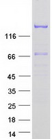 Coomassie blue staining of purified EDRF1 protein (Cat# TP318028). The protein was produced from HEK293T cells transfected with EDRF1 cDNA clone (Cat# RC218028) using MegaTran 2.0 (Cat# TT210002).