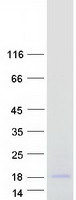 Coomassie blue staining of purified ODAPH protein (Cat# TP318037). The protein was produced from HEK293T cells transfected with ODAPH cDNA clone (Cat# RC218037) using MegaTran 2.0 (Cat# TT210002).