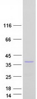 Coomassie blue staining of purified TNFAIP8L3 protein (Cat# TP318511). The protein was produced from HEK293T cells transfected with TNFAIP8L3 cDNA clone (Cat# RC218511) using MegaTran 2.0 (Cat# TT210002).