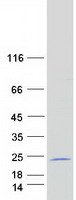 Coomassie blue staining of purified MORN5 protein (Cat# TP318659). The protein was produced from HEK293T cells transfected with MORN5 cDNA clone (Cat# RC218659) using MegaTran 2.0 (Cat# TT210002).