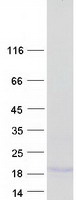 Coomassie blue staining of purified MRAP protein (Cat# TP318683). The protein was produced from HEK293T cells transfected with MRAP cDNA clone (Cat# RC218683) using MegaTran 2.0 (Cat# TT210002).