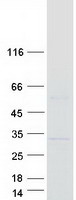 Coomassie blue staining of purified MAJIN protein (Cat# TP319046). The protein was produced from HEK293T cells transfected with MAJIN cDNA clone (Cat# RC219046) using MegaTran 2.0 (Cat# TT210002).