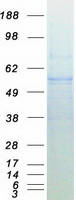 Coomassie blue staining of purified EED protein (Cat# TP319261). The protein was produced from HEK293T cells transfected with EED cDNA clone (Cat# RC219261) using MegaTran 2.0 (Cat# TT210002).