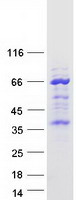 Coomassie blue staining of purified TMEM215 protein (Cat# TP319899). The protein was produced from HEK293T cells transfected with TMEM215 cDNA clone (Cat# RC219899) using MegaTran 2.0 (Cat# TT210002).