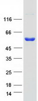 Coomassie blue staining of purified BMT2 protein (Cat# TP320496). The protein was produced from HEK293T cells transfected with BMT2 cDNA clone (Cat# RC220496) using MegaTran 2.0 (Cat# TT210002).