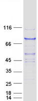 Coomassie blue staining of purified DCAF8 protein (Cat# TP320579). The protein was produced from HEK293T cells transfected with DCAF8 cDNA clone (Cat# RC220579) using MegaTran 2.0 (Cat# TT210002).