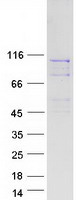 Coomassie blue staining of purified BBS9 protein (Cat# TP321308). The protein was produced from HEK293T cells transfected with BBS9 cDNA clone (Cat# RC221308) using MegaTran 2.0 (Cat# TT210002).