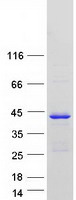 Coomassie blue staining of purified C1orf226 protein (Cat# TP322073). The protein was produced from HEK293T cells transfected with C1orf226 cDNA clone (Cat# RC222073) using MegaTran 2.0 (Cat# TT210002).
