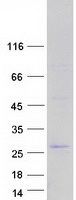 Coomassie blue staining of purified FBXO36 protein (Cat# TP322177). The protein was produced from HEK293T cells transfected with FBXO36 cDNA clone (Cat# RC222177) using MegaTran 2.0 (Cat# TT210002).