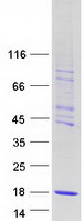 Coomassie blue staining of purified CHTF8 protein (Cat# TP322566). The protein was produced from HEK293T cells transfected with CHTF8 cDNA clone (Cat# RC222566) using MegaTran 2.0 (Cat# TT210002).