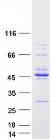 Coomassie blue staining of purified RCCD1 protein (Cat# TP322746). The protein was produced from HEK293T cells transfected with RCCD1 cDNA clone (Cat# RC222746) using MegaTran 2.0 (Cat# TT210002).