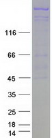 Coomassie blue staining of purified TDRD6 protein (Cat# TP323325). The protein was produced from HEK293T cells transfected with TDRD6 cDNA clone (Cat# RC223325) using MegaTran 2.0 (Cat# TT210002).