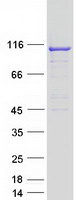 Coomassie blue staining of purified TBC1D2 protein (Cat# TP323443). The protein was produced from HEK293T cells transfected with TBC1D2 cDNA clone (Cat# RC223443) using MegaTran 2.0 (Cat# TT210002).