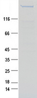 Coomassie blue staining of purified NBAS protein (Cat# TP324157). The protein was produced from HEK293T cells transfected with NBAS cDNA clone (Cat# RC224157) using MegaTran 2.0 (Cat# TT210002).