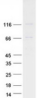 Coomassie blue staining of purified EVC protein (Cat# TP324382). The protein was produced from HEK293T cells transfected with EVC cDNA clone (Cat# RC224382) using MegaTran 2.0 (Cat# TT210002).