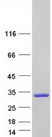 Coomassie blue staining of purified NAA60 protein (Cat# TP324843). The protein was produced from HEK293T cells transfected with NAA60 cDNA clone (Cat# RC224843) using MegaTran 2.0 (Cat# TT210002).