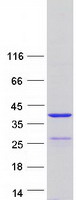 Coomassie blue staining of purified SYCE1L protein (Cat# TP325306). The protein was produced from HEK293T cells transfected with SYCE1L cDNA clone (Cat# RC225306) using MegaTran 2.0 (Cat# TT210002).
