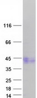 Coomassie blue staining of purified ACVR1C protein (Cat# TP325494). The protein was produced from HEK293T cells transfected with ACVR1C cDNA clone (Cat# RC225494) using MegaTran 2.0 (Cat# TT210002).