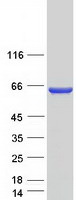 Coomassie blue staining of purified CCDC149 protein (Cat# TP325905). The protein was produced from HEK293T cells transfected with CCDC149 cDNA clone (Cat# RC225905) using MegaTran 2.0 (Cat# TT210002).