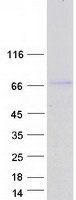 Coomassie blue staining of purified ABLIM2 protein (Cat# TP326056). The protein was produced from HEK293T cells transfected with ABLIM2 cDNA clone (Cat# RC226056) using MegaTran 2.0 (Cat# TT210002).