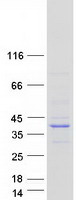 Coomassie blue staining of purified EVPLL protein (Cat# TP326700). The protein was produced from HEK293T cells transfected with EVPLL cDNA clone (Cat# RC226700) using MegaTran 2.0 (Cat# TT210002).