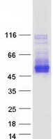 Coomassie blue staining of purified TMEM51 protein (Cat# TP326828). The protein was produced from HEK293T cells transfected with TMEM51 cDNA clone (Cat# RC226828) using MegaTran 2.0 (Cat# TT210002).