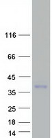 Coomassie blue staining of purified TARM1 protein (Cat# TP326937). The protein was produced from HEK293T cells transfected with TARM1 cDNA clone (Cat# RC226937) using MegaTran 2.0 (Cat# TT210002).