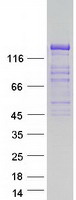 Coomassie blue staining of purified GRID2IP protein (Cat# TP327339). The protein was produced from HEK293T cells transfected with GRID2IP cDNA clone (Cat# RC227339) using MegaTran 2.0 (Cat# TT210002).