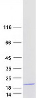 Coomassie blue staining of purified BORCS8 protein (Cat# TP327754). The protein was produced from HEK293T cells transfected with BORCS8 cDNA clone (Cat# RC227754) using MegaTran 2.0 (Cat# TT210002).