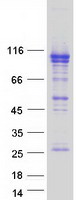 Coomassie blue staining of purified OSBPL5 protein (Cat# TP327756). The protein was produced from HEK293T cells transfected with OSBPL5 cDNA clone (Cat# RC227756) using MegaTran 2.0 (Cat# TT210002).