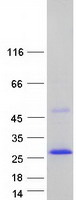 Coomassie blue staining of purified SSPN protein (Cat# TP327888). The protein was produced from HEK293T cells transfected with SSPN cDNA clone (Cat# RC227888) using MegaTran 2.0 (Cat# TT210002).