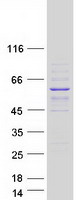 Coomassie blue staining of purified CCDC169-SOHLH2 protein (Cat# TP331278). The protein was produced from HEK293T cells transfected with CCDC169-SOHLH2 cDNA clone (Cat# RC231278) using MegaTran 2.0 (Cat# TT210002).