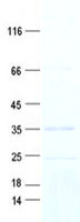 TRAF4AF1 (KNSTRN) (NM_001142762) Human Recombinant Protein